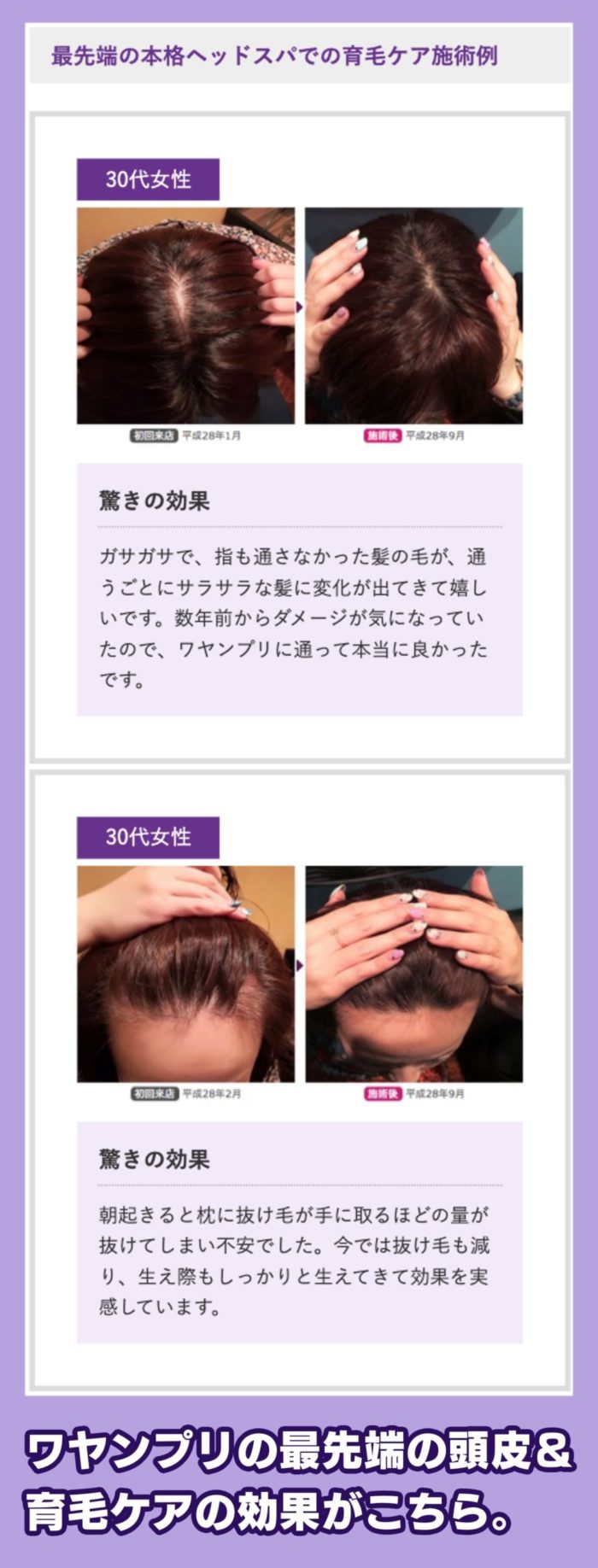 ワヤンプリの育毛ケア施術例