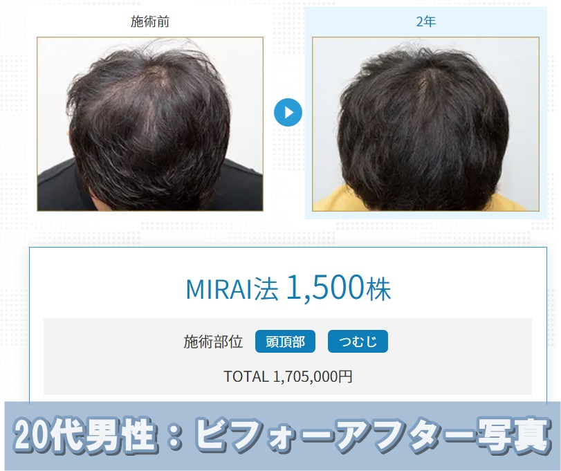 親和クリニックビフォーアフター写真:20代男性