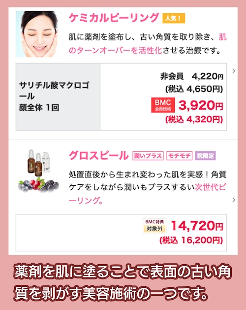 ピーリングによる治療