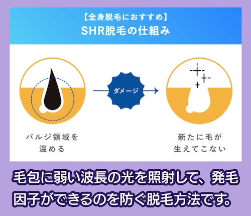 oneself SHR(OPI)方式光脱毛