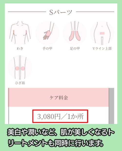 PMKの都度払いの脱毛の料金
