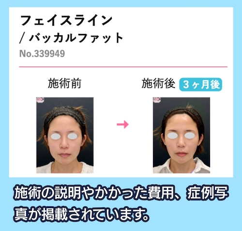 湘南美容クリニック 症例写真