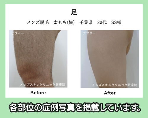 メンズスキンクリニック 銀座院 症例写真