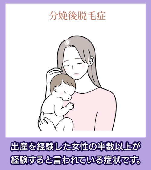分娩後脱毛症