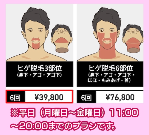 ゴリラクリニックの料金相場