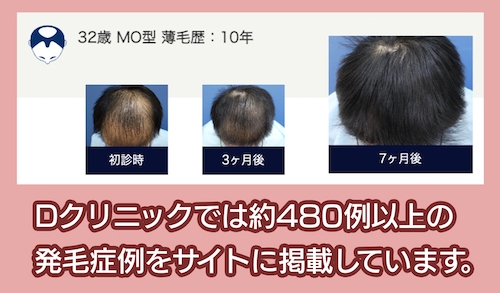 Dクリニック 症例写真