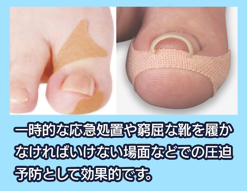 大木皮膚科 テーピング法