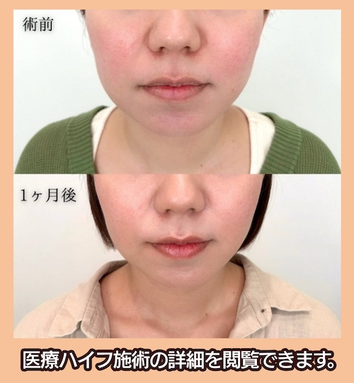 東京中央美容外科 症例写真