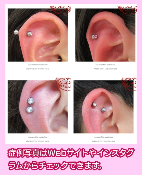 にしやま形成外科皮フ科クリニック 症例写真