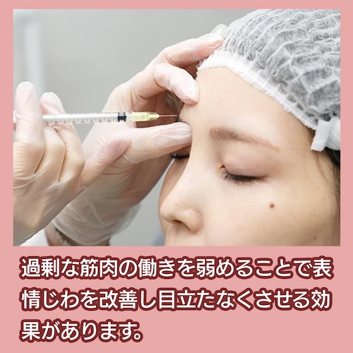 銀座よしえクリニック ボトックス注射