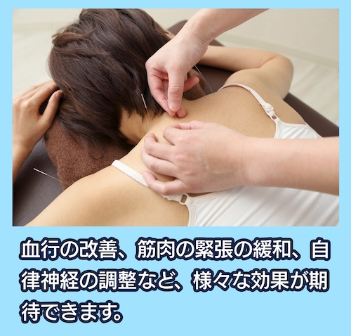 サルビア整骨院 鍼（はり）治療