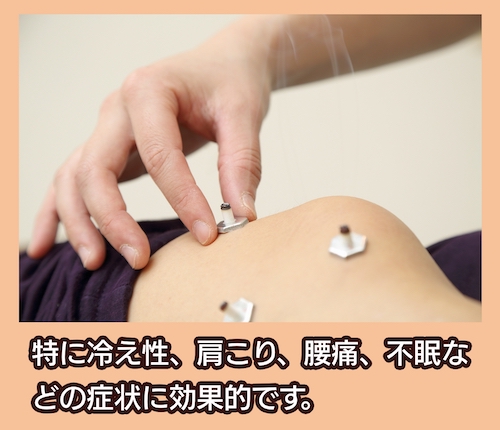 サルビア整骨院 灸（きゅう）治療