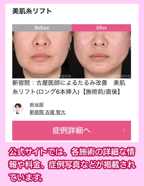 品川美容外科 施術事例