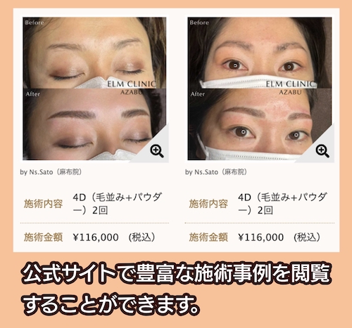 エルムクリニック 施術事例