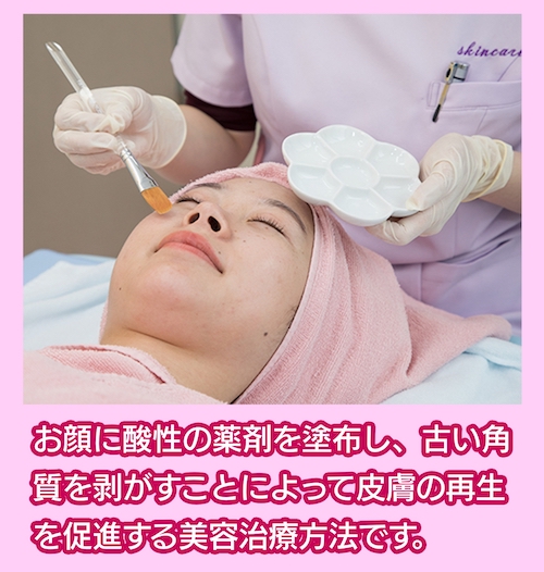 宇都宮スキンケアクリニック ケミカルピーリング