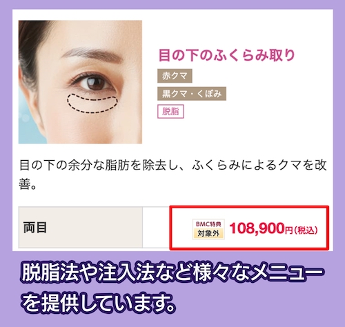 品川スキンクリニックのクマ取りの料金